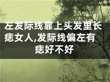 左发际线靠上头发里长痣女人,发际线偏左有痣好不好