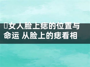 ​女人脸上痣的位置与命运 从脸上的痣看相